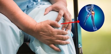 Gai thoái hóa khớp gối: Nguyên nhân và cách điều trị