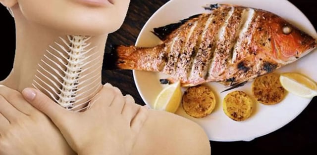 Hóc xương cá &#8211; Xử trí đúng cách để tránh nguy hại