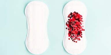 Các phương pháp điều trị rong kinh rong huyết hiệu quả