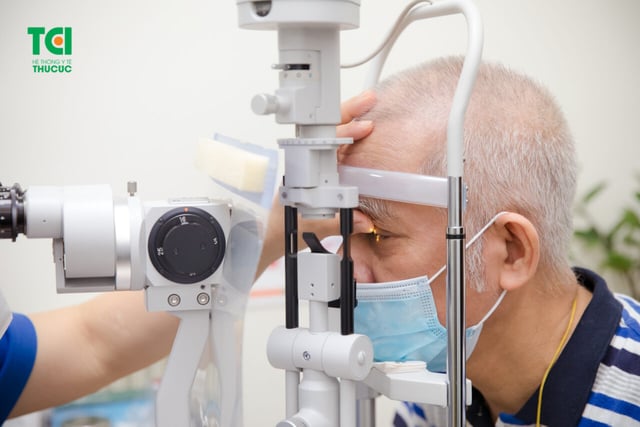 Giải phóng sức ép cho đôi mắt đục thủy tinh thể nặng