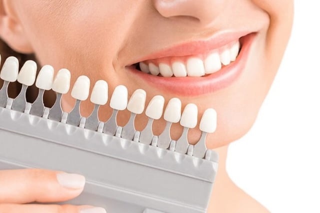 Tác hại của bọc răng sứ giá rẻ, kém chất lượng