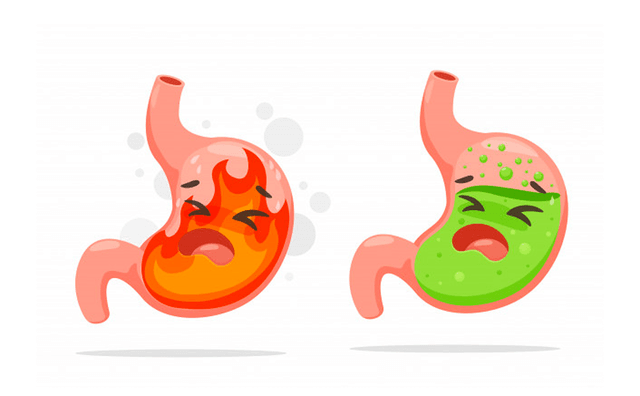 Bệnh trào ngược dạ dày &#8211; Triệu chứng, nguyên nhân