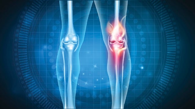 Triệu chứng viêm khớp nhiễm khuẩn bạn cần biết