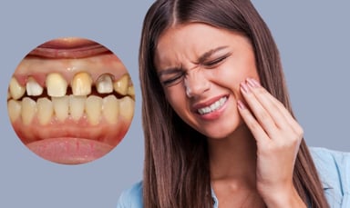 Bọc răng sứ có đau không và cách hạn chế đau nhức