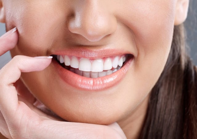Giải đáp vấn đề bọc răng sứ nên chọn loại nào