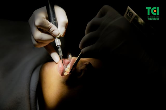 Điểm danh các cách trị sâu răng bị đen