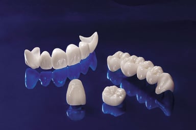 Có nên bọc răng sứ kim loại – Thắc mắc của nhiều người
