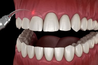 Dành cho những người muốn biết điều trị cười hở lợi ở đâu
