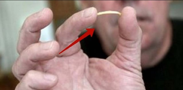 Từ A đến Z các kinh nghiệm chữa hóc xương cá thực tế