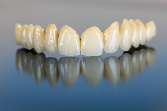 6 Loại răng sứ cao cấp được ưa chuộng hiện nay