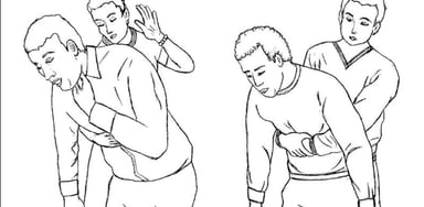 Đề phòng và xử lý người bị hóc dị vật đường thở đúng cách