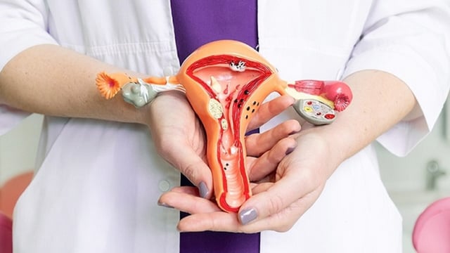 Viêm âm đạo &#8211; Bệnh phụ khoa thường gặp ở phụ nữ