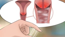 Các dấu hiệu cảnh báo bệnh viêm âm đạo