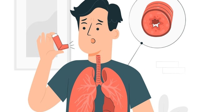 Cách trị hen phế quản tại nhà không phải ai cũng biết