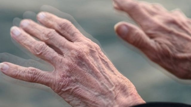 Phân biệt bệnh run vô căn và Parkinson &#8211; những điều cần biết