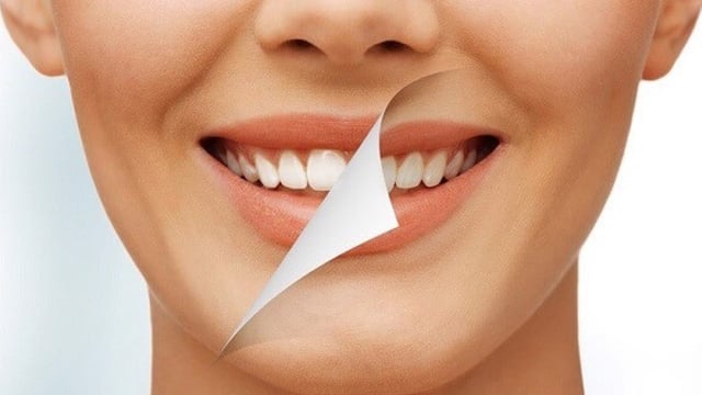 Những lưu ý về tẩy trắng răng an toàn không thể bỏ qua