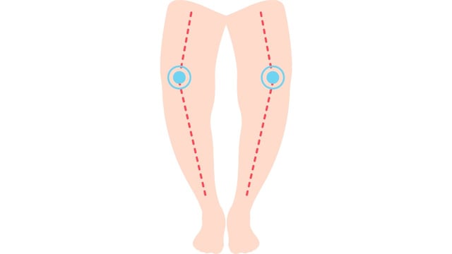 Trẻ còi xương: Những nguyên tắc điều trị cốt lõi
