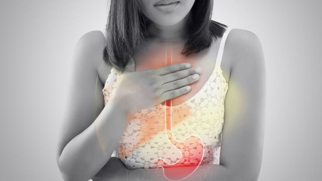 Trào ngược dạ dày gây ho kéo dài &#8211; Cơ chế hình thành