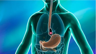 Tìm hiểu ợ nóng có hại không, nguyên nhân và cách điều trị