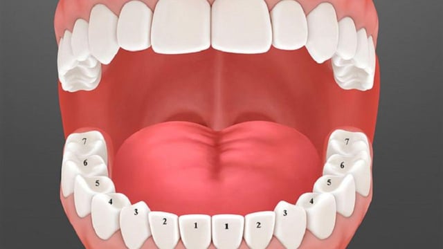 Triệu chứng, nguy cơ và giải pháp điều trị răng số 5 mọc ngầm