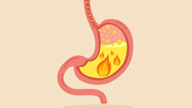 Điều trị dạ dày trào ngược mãi không khỏi &#8211; Lý giải nguyên nhân 