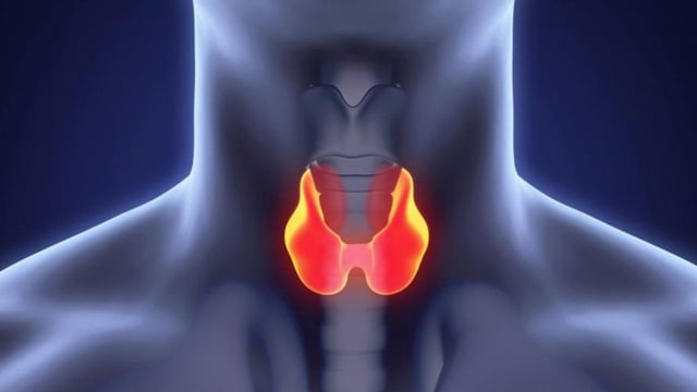 Bệnh Basedow: Nguyên nhân, triệu chứng và điều trị