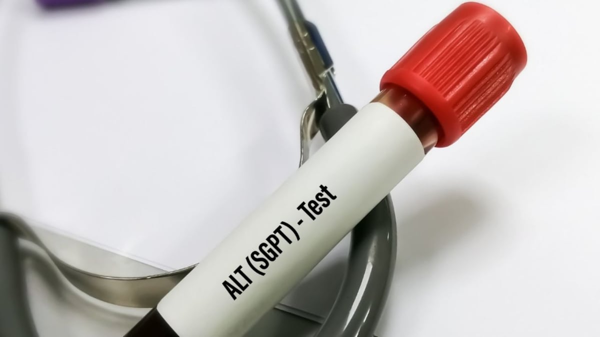 Mối liên hệ giữa men gan cao và gan nhiễm mỡ