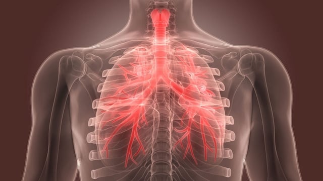 Nhận biết triệu chứng viêm phế quản phổ biến