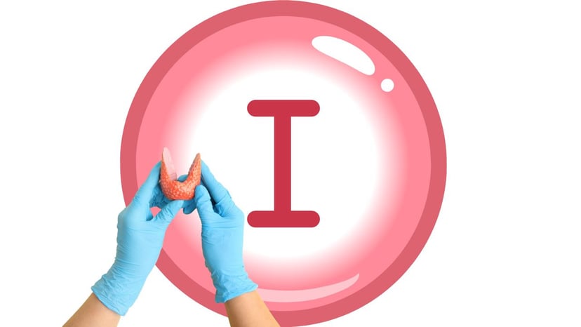 U giáp lành tính có liên quan đến thiếu iod không? Lý giải chi tiết