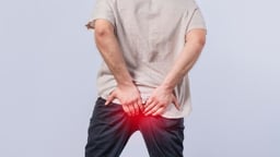 Người bị trĩ ngoại cần lưu ý gì để cải thiện sức khỏe?