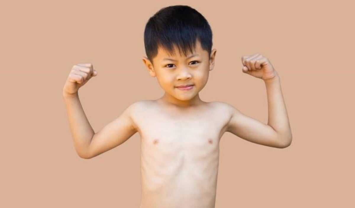 Nguyên nhân tiềm ẩn khiến trẻ bị suy dinh dưỡng kéo dài