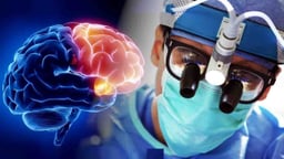 Những điều cần biết về sinh thiết não