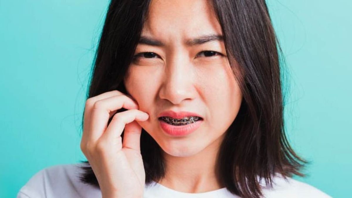 Niềng răng đau không &#8211; Một số giai đoạn cần chú ý