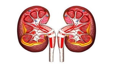 Làm sao để hết thận ứ nước: Cách điều trị và phòng ngừa hiệu quả