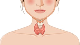 Nguyên nhân gây bệnh Basedow: Yếu tố khách quan và chủ quan