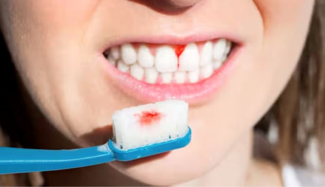 Viêm chân răng cửa: Sự thật đằng sau những cơn đau dai dẳng