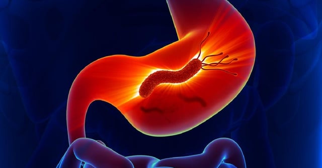 Nhiễm HP: Tìm hiểu nguyên nhân, mức nguy hiểm và cách chữa