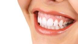 Cười hở lợi: Nguyên nhân xảy ra và phương pháp điều trị an toàn