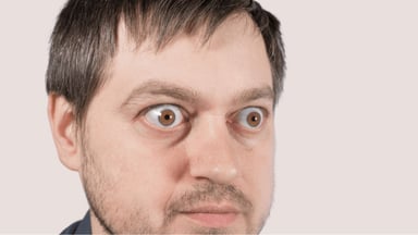 Mắt lồi nhẹ: Khi nào bạn cần thăm khám và can thiệp sớm