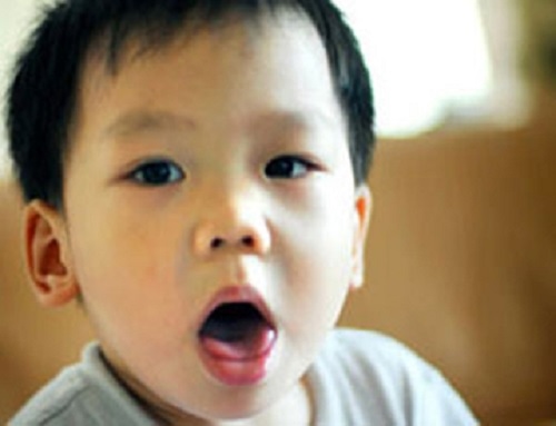 benh-hen-phe-quan-co-di-truyen-khong.jpg1