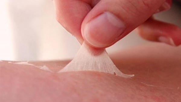 Sau 1 tuần thì các mảng da bị phồng rộp của tôi đang tróc ra và hình thành lớp da mới.