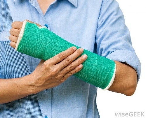 Nẹp được áp dụng với các vết thương mới kết hợp với nghỉ ngơi là cách điều trị gãy xương do loãng xương ở người già