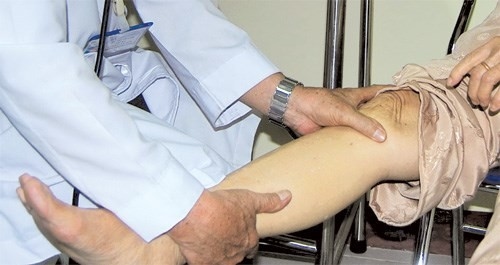 Cách điều trị bệnh đau khớp gối khi lên xuống cầu thang