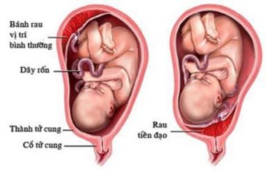 Những điều cần biết về nhau tiền đạo