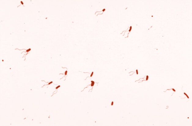 Ho gà phát sinh do trực khuẩn gram âm Bordetella. pertussis