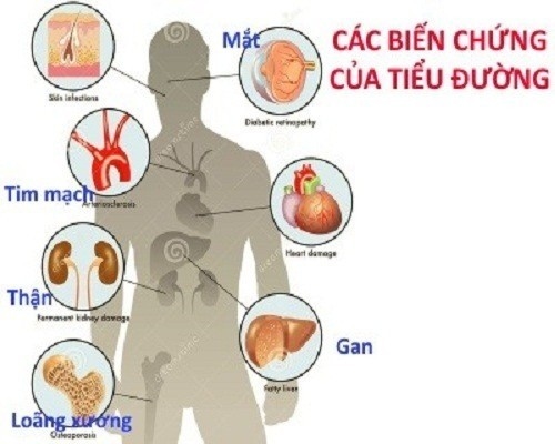 Bệnh tiểu đường ảnh hưởng nghiêm trọng đến bệnh tiểu đường