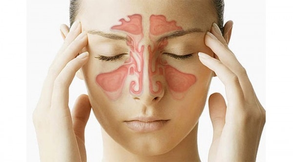 Viêm xoang ảnh hưởng không nhỏ đến đời sống sinh hoạt hàng ngày của bệnh nhân