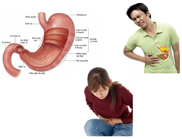Nội soi dạ dày là thủ thuật bắt buộc trong thăm khám để phát hiện sớm và chính xác các bệnh lý bất thường tại dạ dày.