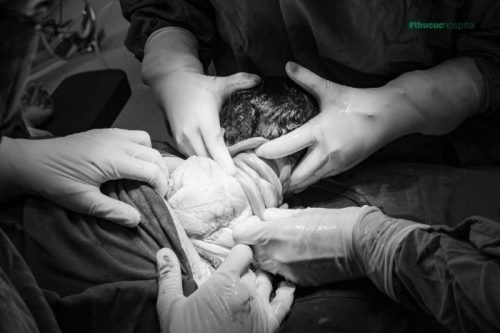 Hiện tượng dây rốn quấn cổ chỉ thường xảy ra do tư thế xoay chuyển của em bé ở trong tử cung trước khi sinh bà bầu có được với tay cao