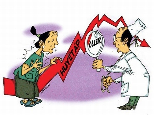 Tăng huyết áp cần được điều trị sớm và đúng cách